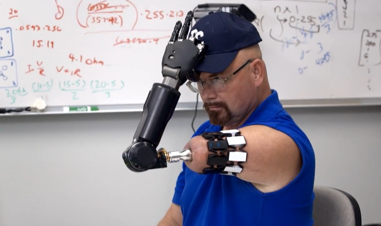 Advanced bionic limbs