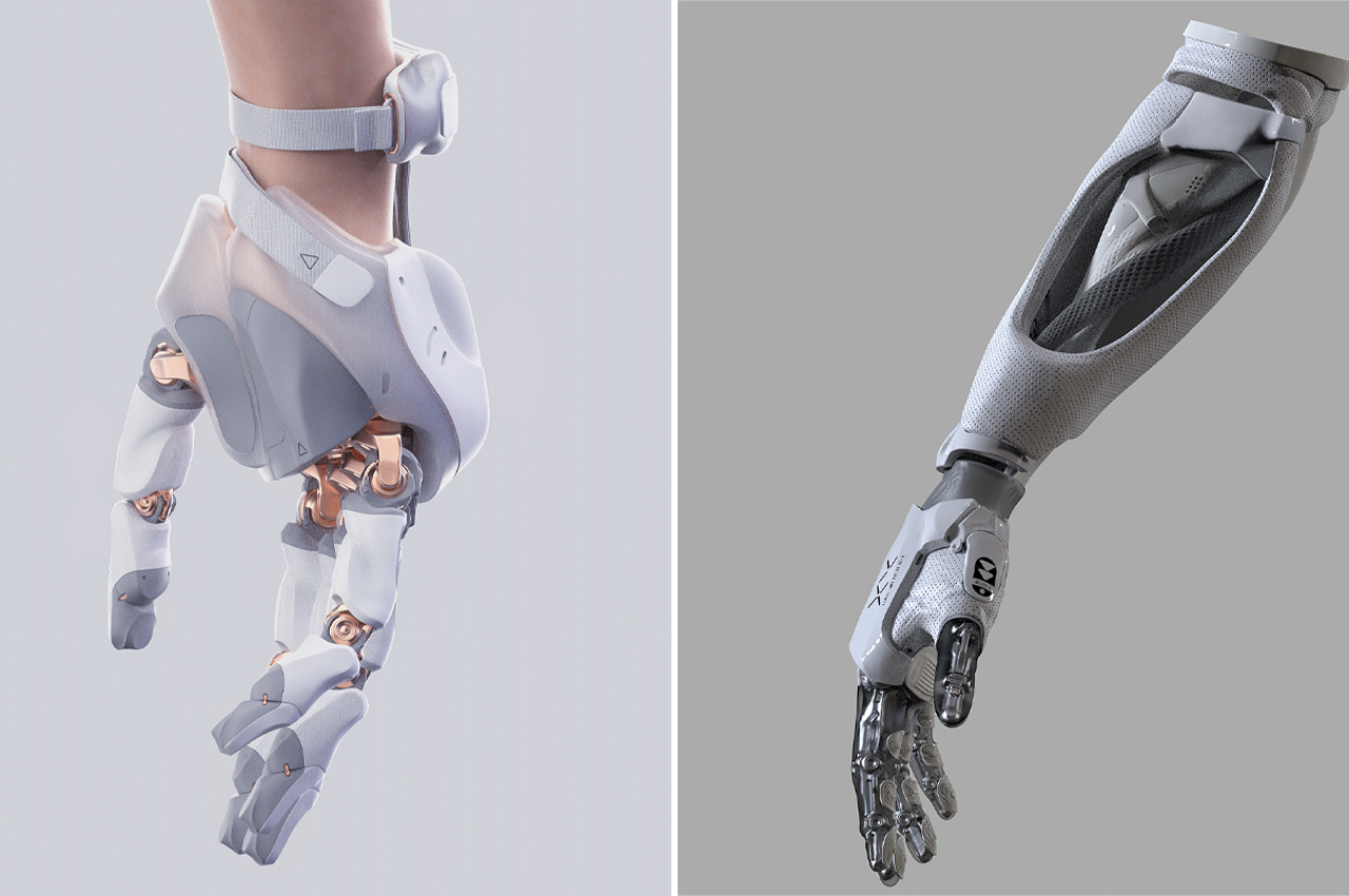 User interface of AI-driven prosthetic software